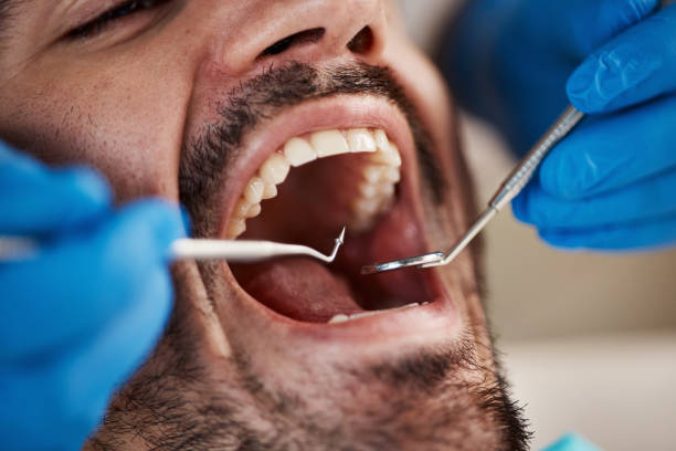 Best Weekend Emergency Dentist in Walnut Cove, NC